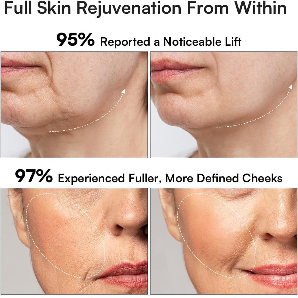 Red Light Therapy Facial Massager–Microcurrent Skin Rejuvenation Device